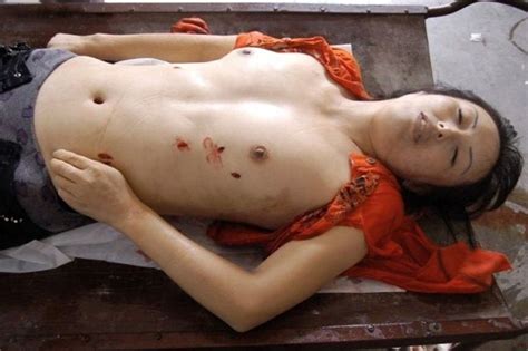 Selena Quintanilla Perez On An Autopsy Table In Morgue. 
