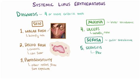 Systemic Lupus Erythematosus Sle Causes Symptoms Diagnosis