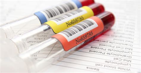 This set is often saved in the same folder as. Should I be tested? Ask These 4 Questions First