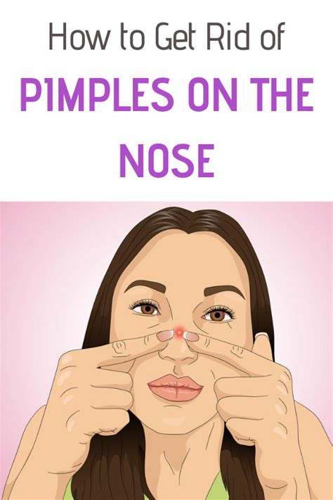 How To Get Rid Of Pimples On The Nose