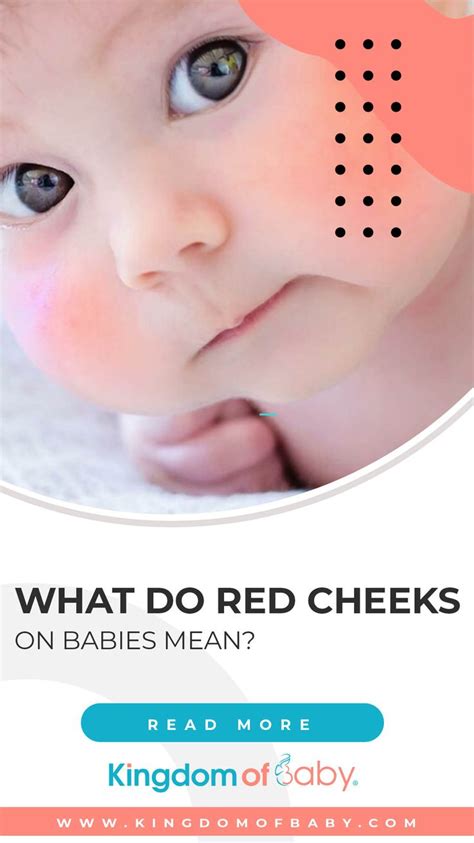 What Do Red Cheeks On Babies Mean Kingdom Of Baby Baby Red Cheeks