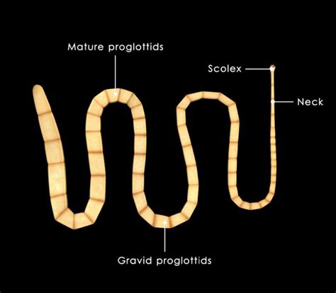 Understanding Tapeworm Infections And Their Impact On Health