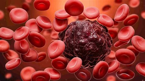 Blood Cancer Stage 4 Survival Rate And How To Increase It 2023