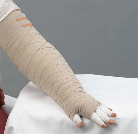 Lymphedema Wrapping Body Of Health