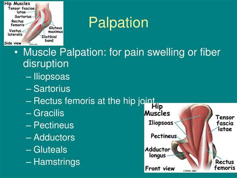 Ppt Hip Assessment Powerpoint Presentation Free Download Id1898846