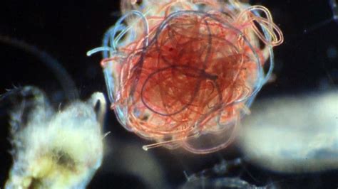 Microscopic Marine Organisms Like These Are Encountering A Growing