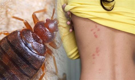 Bed bugs can also be found in sofas, mattresses, chairs, sheets, blankets, suitcases, cardboard boxes, cluttered areas, and other similar furniture items. Bed bugs: There are four home remedies to getting rid of ...