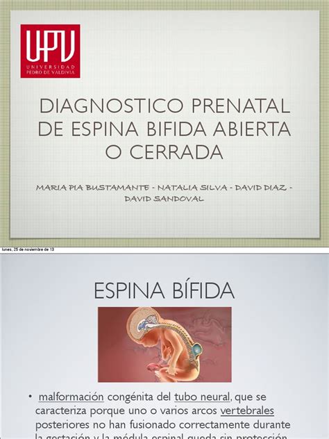 Presentacion Espina Bifida Neurología Enfermedades Y Trastornos