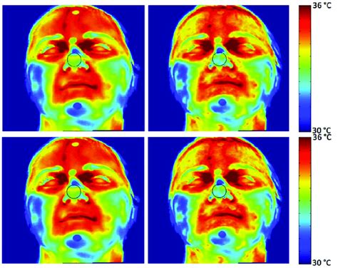 Facial Thermal Changes In A Representative Subject On The Left The