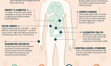 The Guide To Good Bacteria Daily Infographic