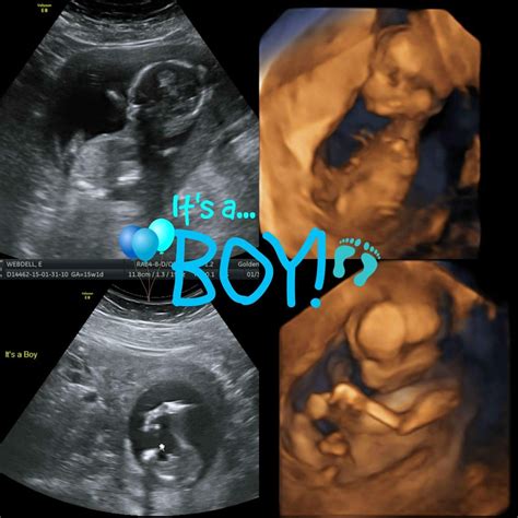 Turning many ultrasound photos to canvas art diy canvas. Baby Boy Webdell ... fantastic pics from GoldenView ...