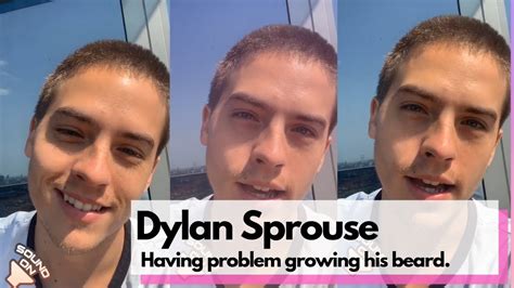 Dylan Sprouse Having Problem Growing His Beard Youtube