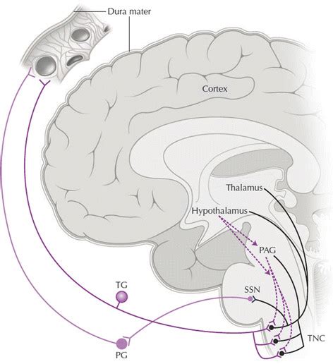 Schematic Depiction Of The Trigeminal Autonomic Reflex And Related