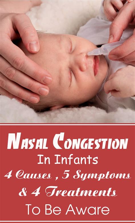 Infant Nasal Congestion 5 Symptoms And 10 Causes You Should Be Aware Of