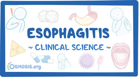 Esophagitis Clinical Sciences Osmosis Video Library