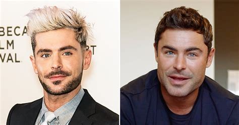 Zac Efrons Face Looks Totally Different As Fans Speculate Fillers