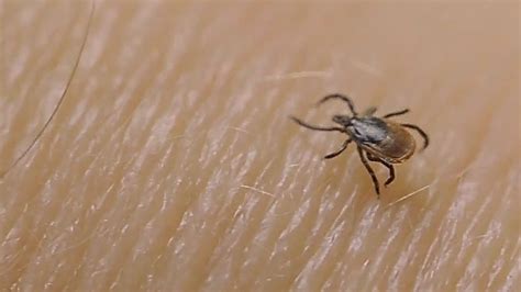 Allergic Reaction To Red Meat Could Be Caused By Tick Bite Kokh