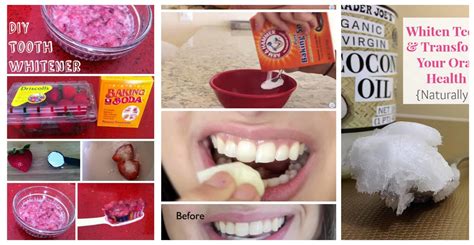 The Best Homemade Remedies To Whiten Your Teeth Naturally All For Fashion Design