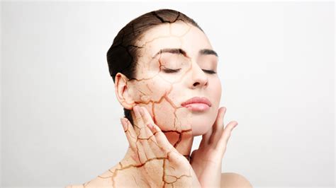 Dermatologists Top Tips For Relieving Dry Skin Dr Lipy Gupta