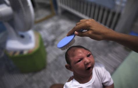 Microcephaly Is Just The Tip Of The Iceberg First Direct Proof Zika