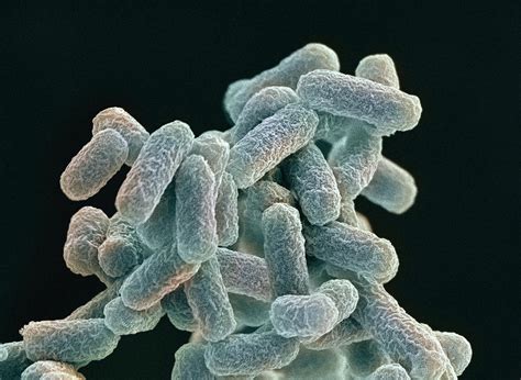 E Coli Bacteria Sem Photograph By Steve Gschmeissner