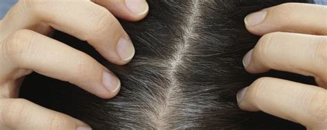 Excess Sebum And Hair Loss We Know The Answer Viviscal Healthy Hair Tips