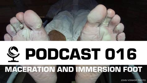 Podcast 016 Skills Short Maceration And Immersion Foot