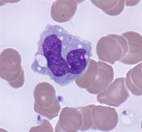Normal Monocytes