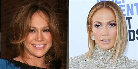 Jennifer Lopez Denies Plastic Surgery Face Before And After