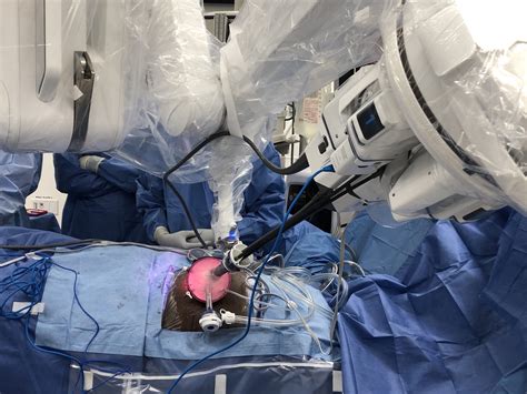 Cleveland Clinic First In The World To Perform Robotic Single Port