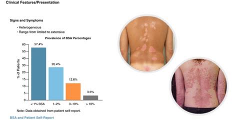 Psoriasisclinicalpicture