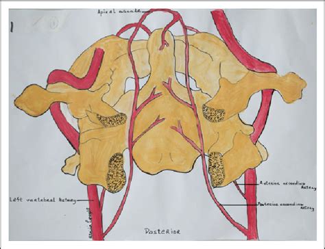 Posterior View Of Atlas C1 And Axis C2 With Related Vascular