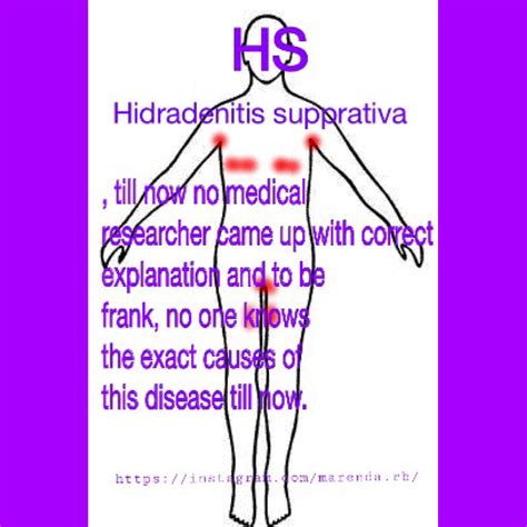 Hidradenitis Supprativa Hidradenitis Hidradenitissuppurativa
