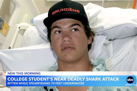 College Student Blindsided By Shark Bite While Fishing