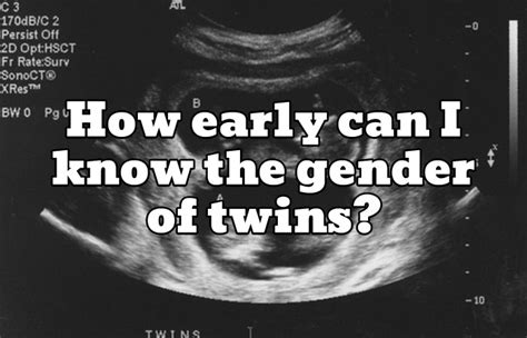 How Early Can I Know The Gender Of Twins Dads Guide To Twins