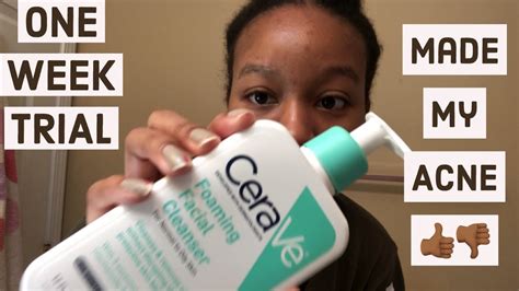 I Tried Cerave Cleanser On My Acne Prone Skin For One Week Before And