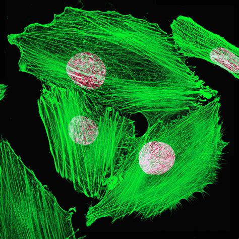 Three Neuroblastoma Cells Green Original Photograph By Art Of