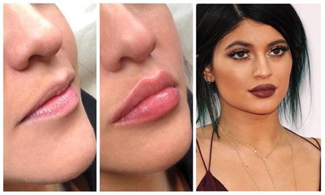 Kylie Jenner Lipstick On Indian Skin Famous Person