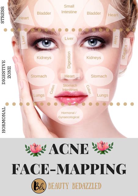 Acne Face Mapping What Does Your Acne Tell You Homemade Acne