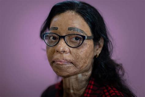 Indian Acid Attacks Are On The Rise And The Women Who Survive Them Are Forced To Live As
