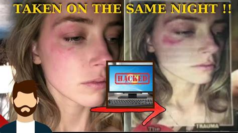 Amber S ICloud Folder Got H CKED Leaking INSANE Fake Bruise Photos YouTube