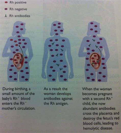 Topics » signs of pregnancy. Advil Help Heartburn | Stomach Acid Heartburn