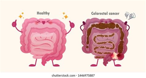 Healthy Unhealthy Intestine Colorectal Cancer Issue Stock Vector