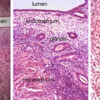 Uterine Gland Histology