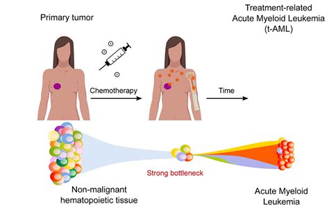 Teleskop Leninismus Hoppla Platin Chemo Chemotherapie W Chentlich Weint