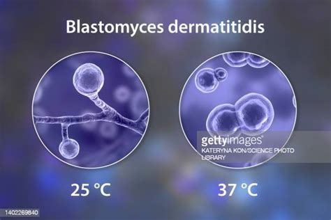 Blastomyces Photos And Premium High Res Pictures Getty Images