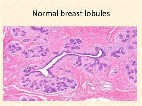 Ppt Breast Powerpoint Presentation Free Download Id1951453