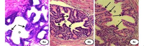 The Duct Of The Glandular Unit Of The Prostate Gland With Epithelial