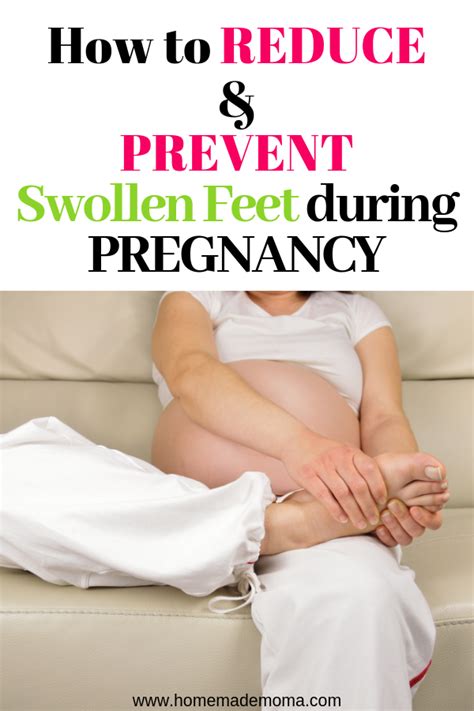 Swollen Feet During Pregnancy Artofit