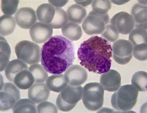 Monocyte With Arch Shaped Nucleus Besides An Eosinophil With Three